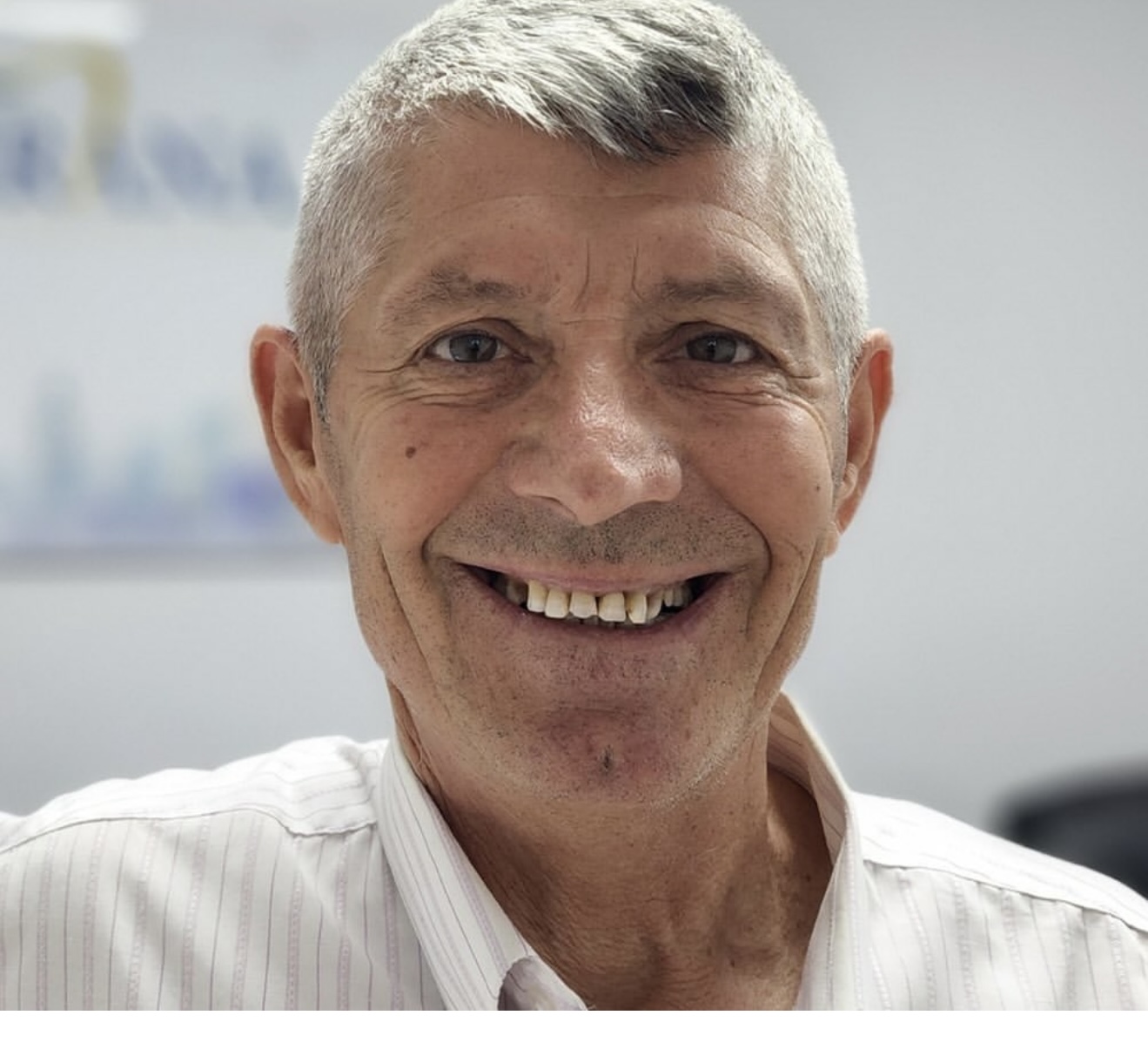 Before 10 Emax Veneers